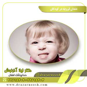 دندان قروچه در کودکان