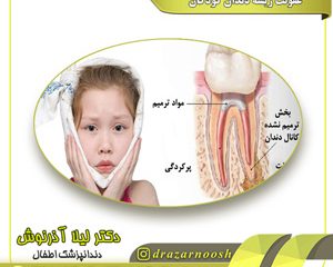عفونت ریشه دندان کودکان