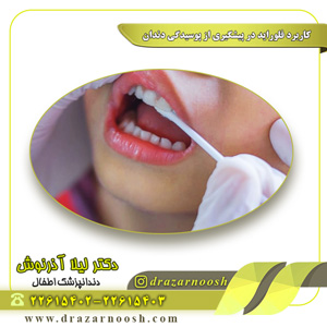 کاربرد فلوراید در پیشگیری از پوسیدگی دندان