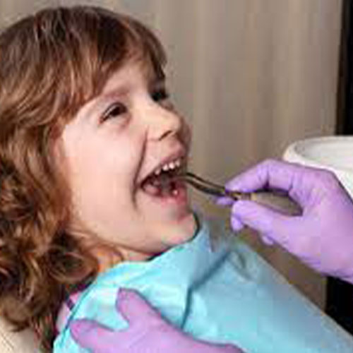 زراعة الأسنان عند الأطفال