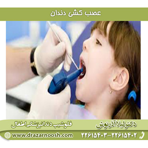 عصب‌-کشی-دندان-کودکان1