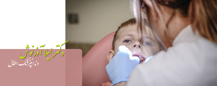 مزایای درمان ریشه دندان در کودکان