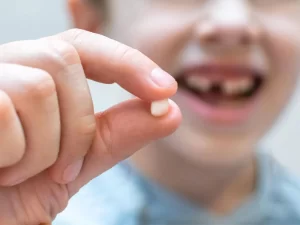 کشیدن دندان شیری