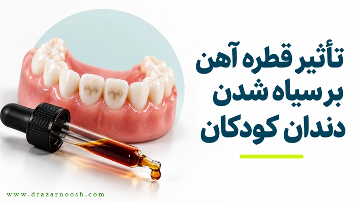 چگونه از سیاه شدن دندان کودک هنگام مصرف قطره آهن جلوگیری کنیم؟