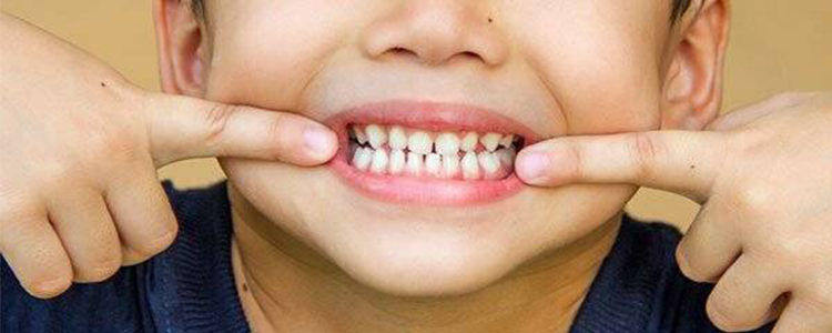 درمان پوسیدگی دندان کودکان