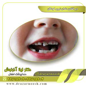 دیر افتادن دندان شیری کودکان