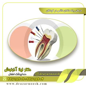 درمان ریشه دندان دائمی در کودکان