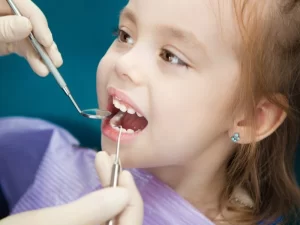 مراقبت های بعد از فلوراید تراپی دندان کودکان