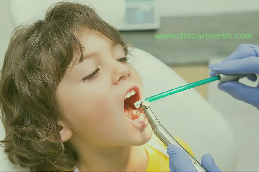 ایمپلنت دندان توسط بهترین دندانپزشک اطفال