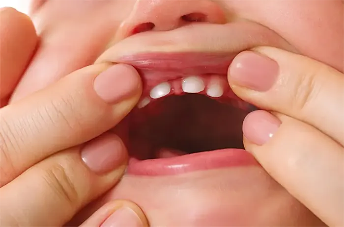  کاهش درد دندان درآوردن کودک