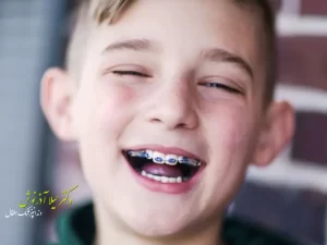 مزایای ارتودنسی پیشگیری دندان