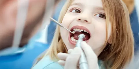 ایمپلنت دندان کودک