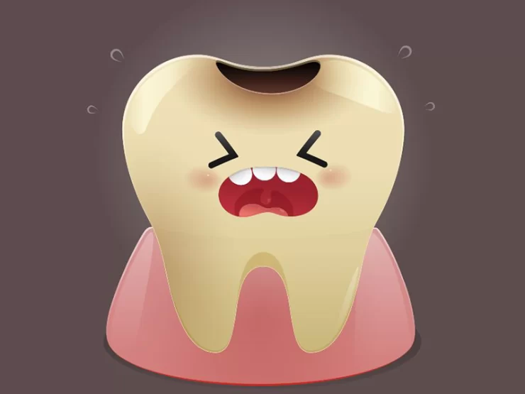 عصب کشی دندان کودکان