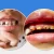 پیشگیری از پوسیدگی دندان کودکان