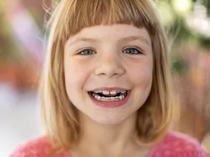 ارتودنسی دندان کودکان