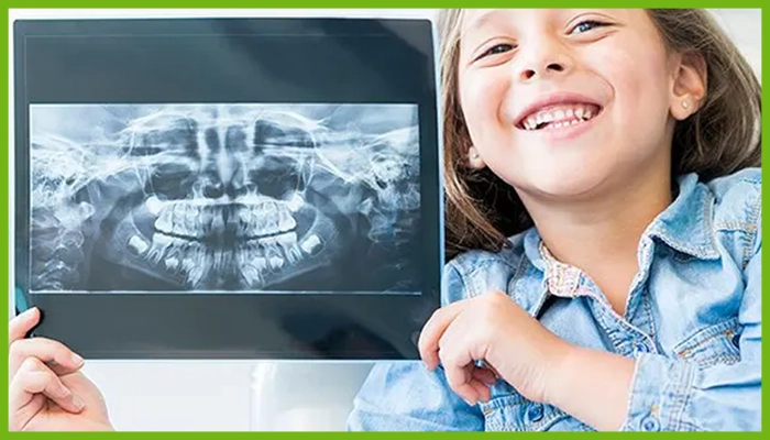 رادیوگرافی دندان کودکان