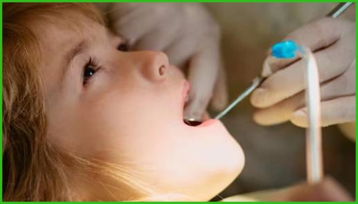 آیا عصب کشی دندان کودکان درد دارد