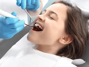 مراقبت بعد از فیشورسیلانت