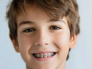 بهترین سن ارتونسی دندان کودکان